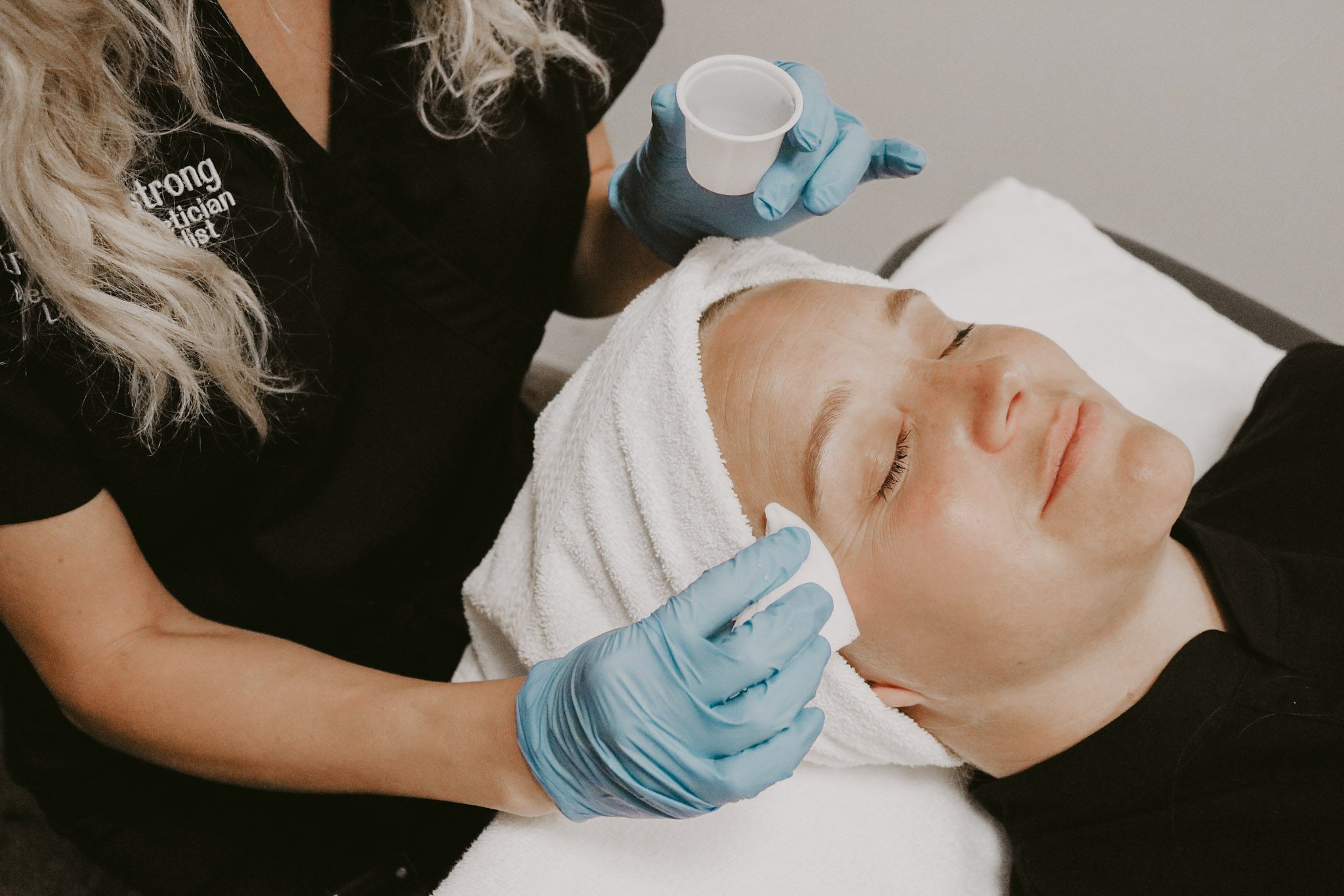 Find Out Which Chemical Peel is Right for You