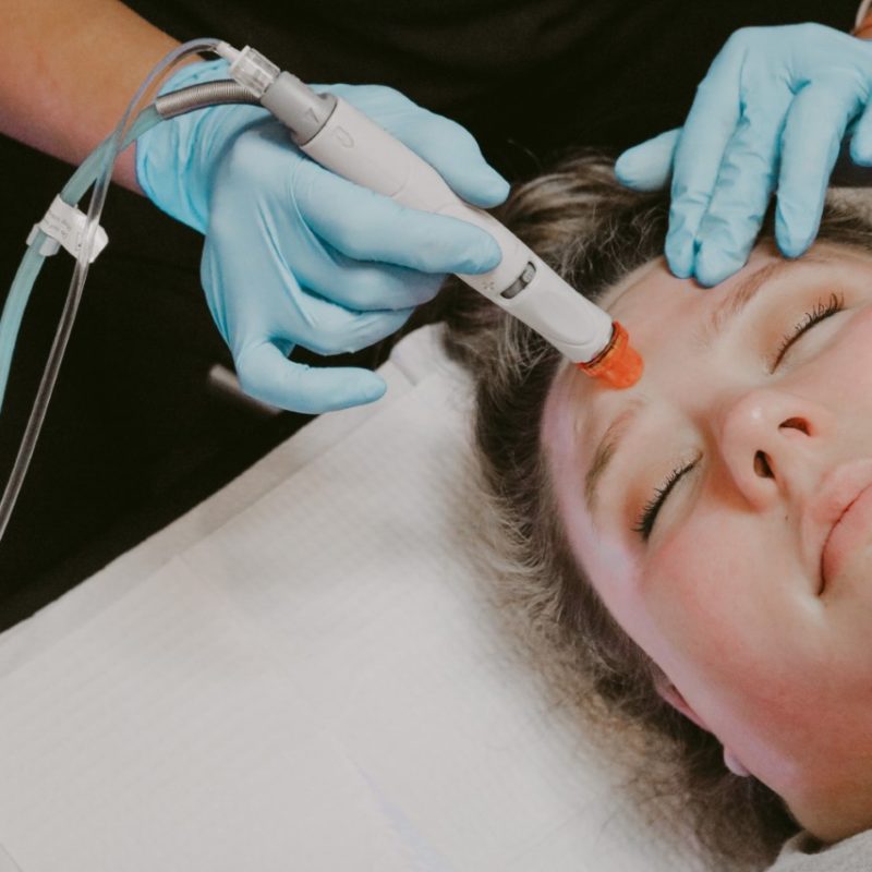 HydraFacial Elan Skin and Laser