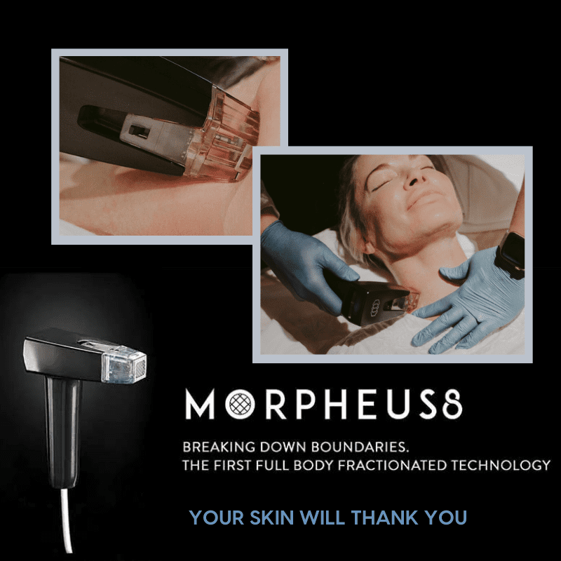 Morpheus8: The New, Revolutionary Skin Treatment