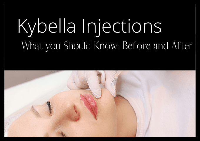Kybella Injections: what you should know