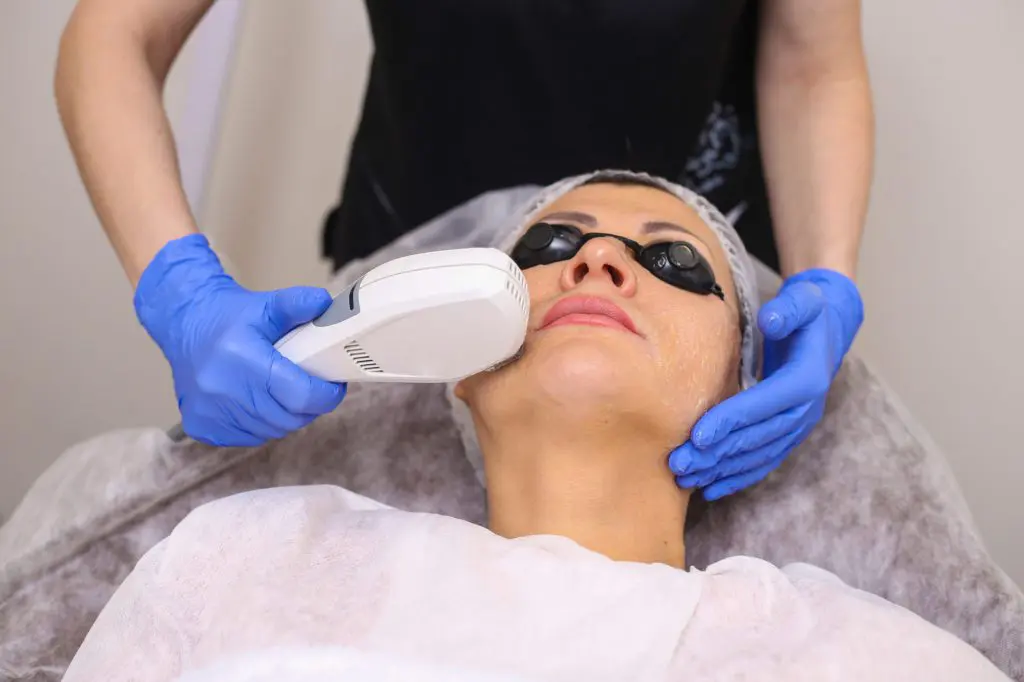 pre-treatment-guide-for-ipl-for-hyperpigmentation