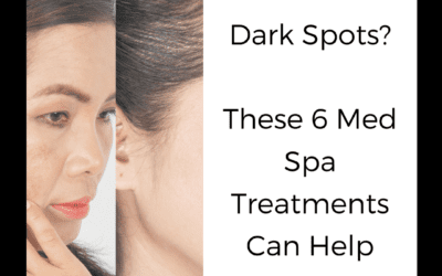 Dark Spots? These 6 Med Spa Treatments can help