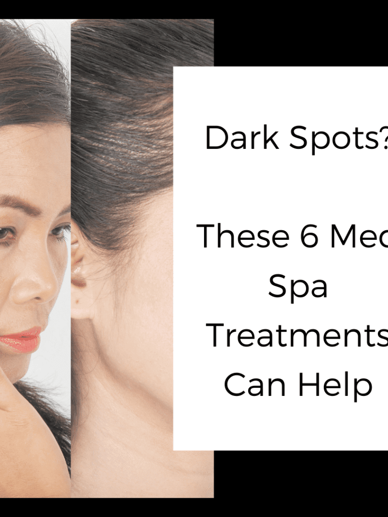 Dark Spots? These 6 Med Spa Treatments can help