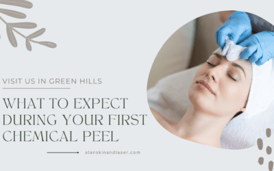 What to Expect During Your First Chemical Peel