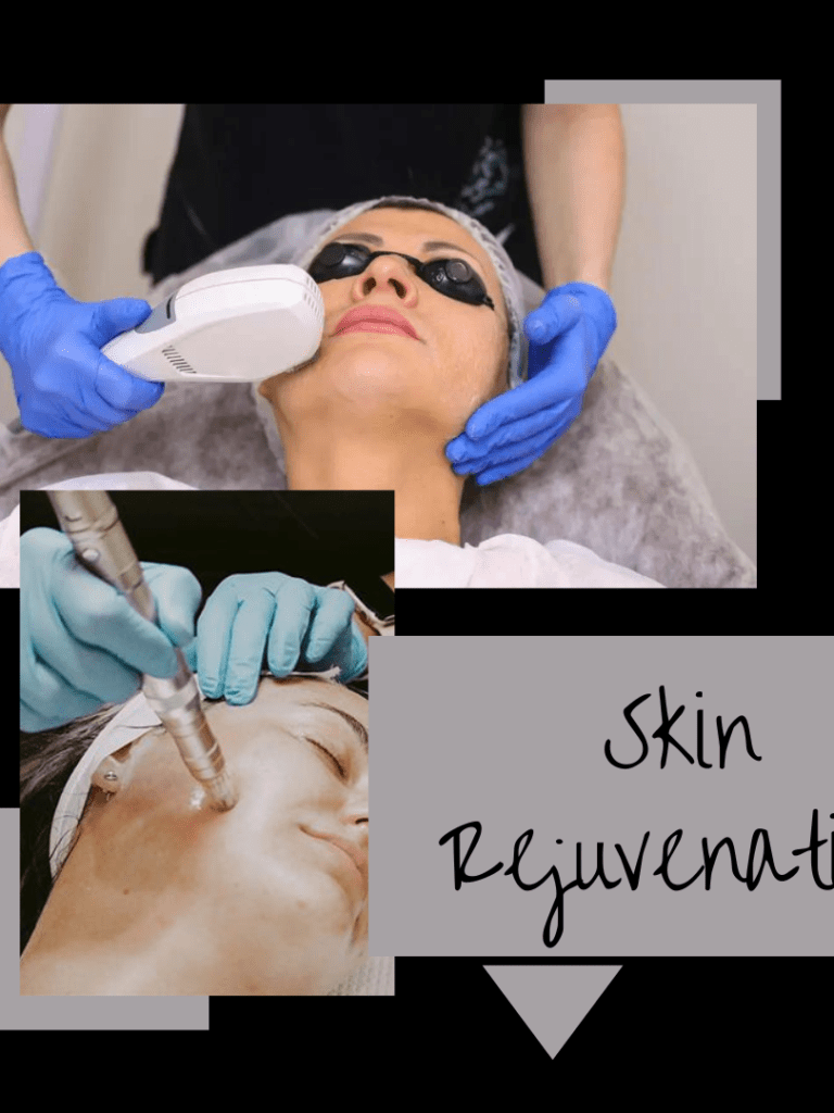 Skin Rejuvenation