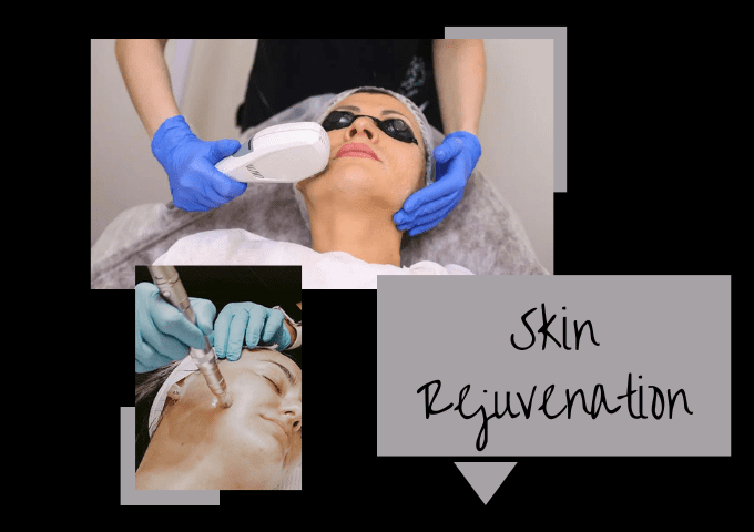 Skin rejuvinariton in Nashville