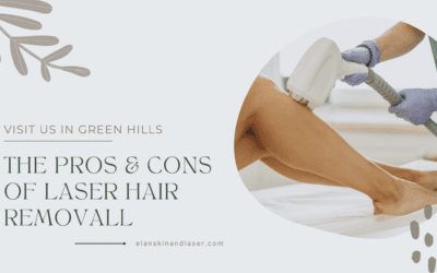 The Pros and Cons of Laser Hair Removal