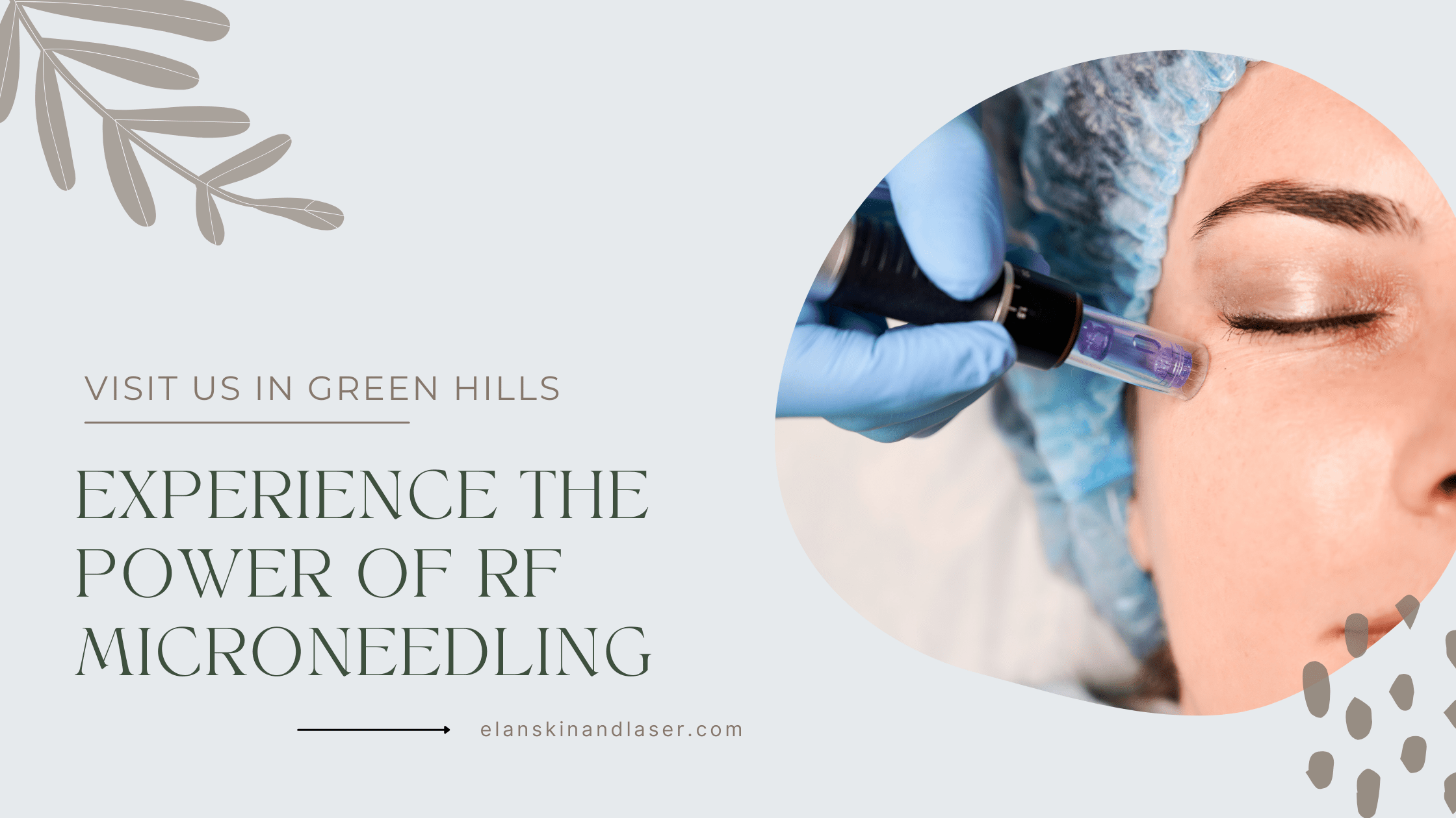 RF Microneedling Nashville