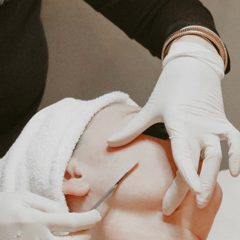 dermaplaning_sqr