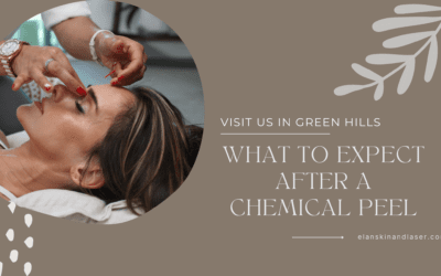 The Recovery Process: What to Expect After a Chemical Peel at Elan Skin