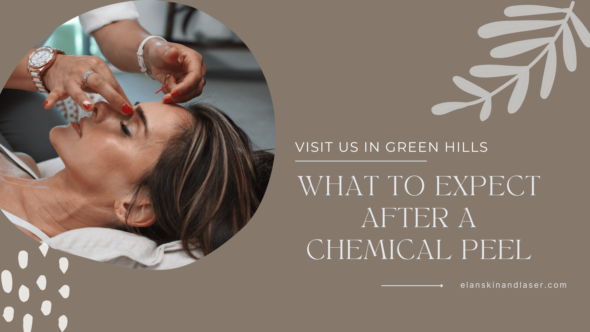 what to expect after a chemical peel