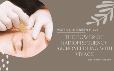 Experience the Power of Radiofrequency Microneedling with Vivace at Elan Skin