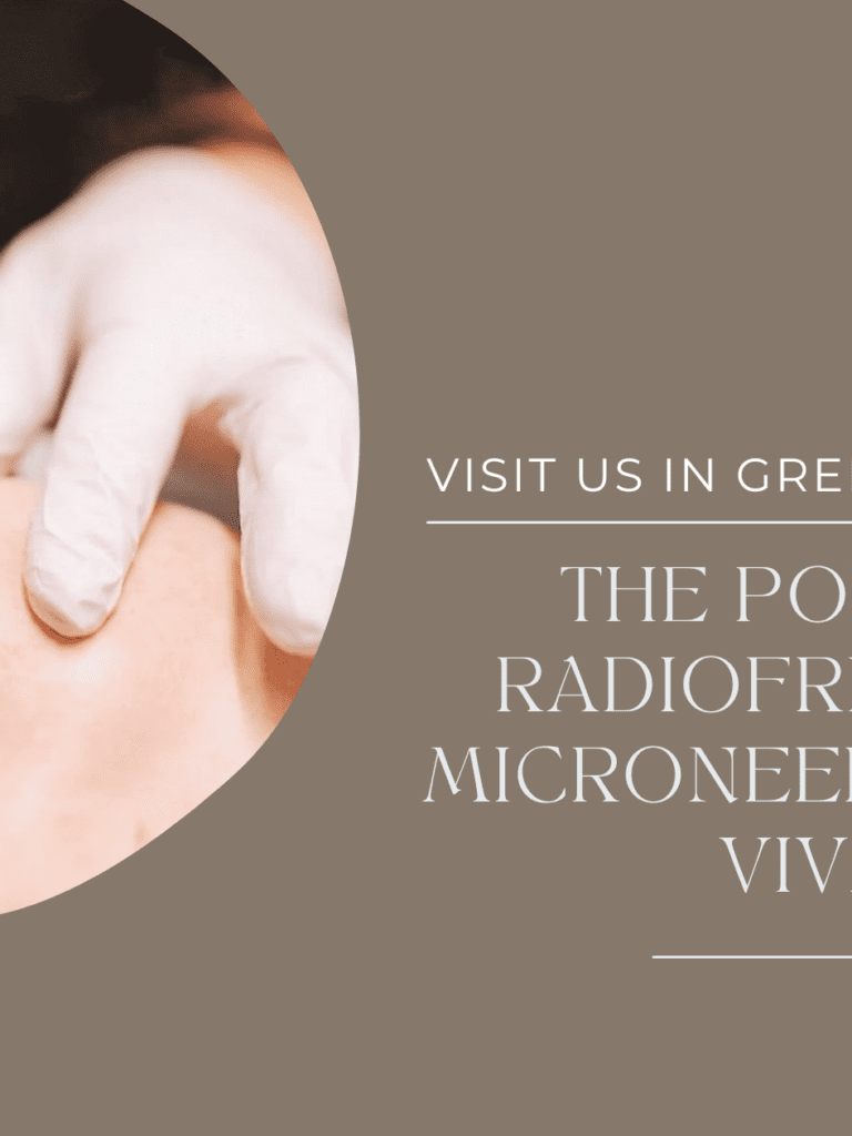 Experience the Power of Radiofrequency Microneedling with Vivace at Elan Skin