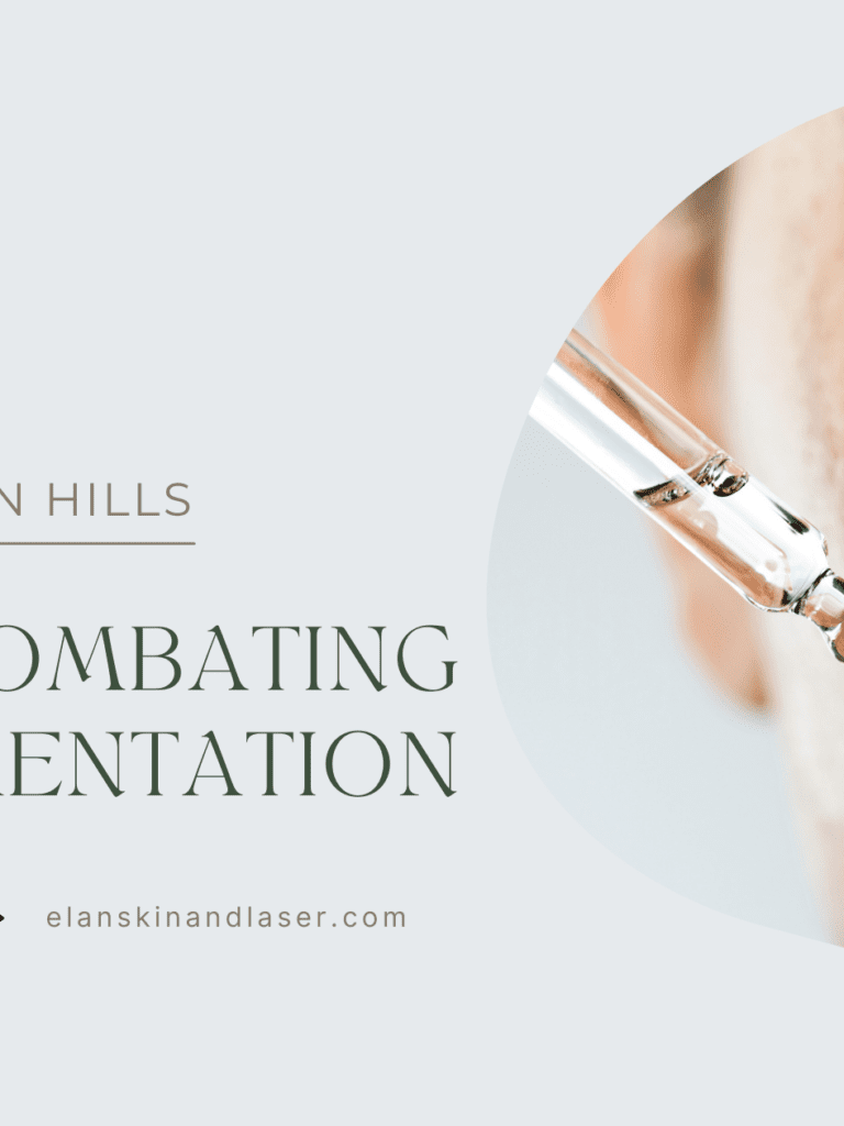 Achieving Radiant Skin: Strategies for Combating Hyperpigmentation
