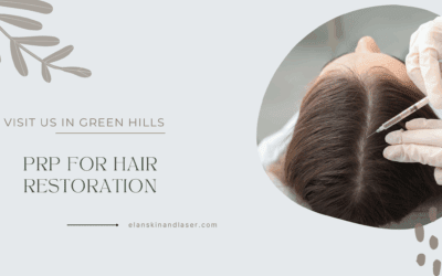 PRP for Hair Restoration: Get Thicker, Fuller Hair Just in Time for Summer