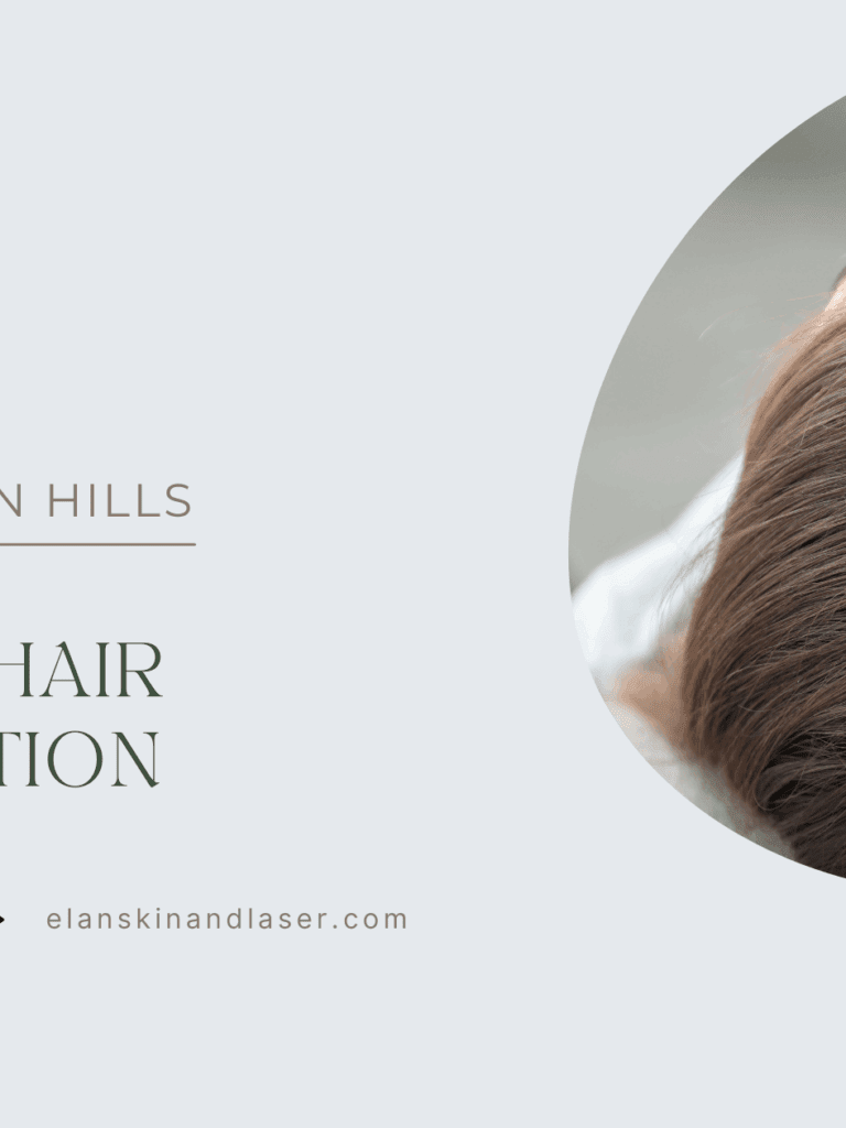 PRP for Hair Restoration: Get Thicker, Fuller Hair Just in Time for Summer