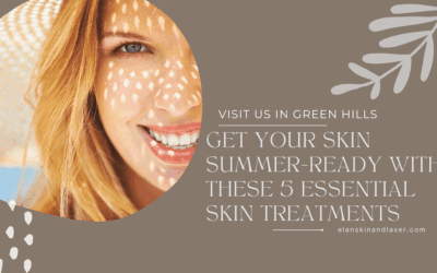 Get Your Skin Summer-Ready with These 5 Essential Skin Treatments