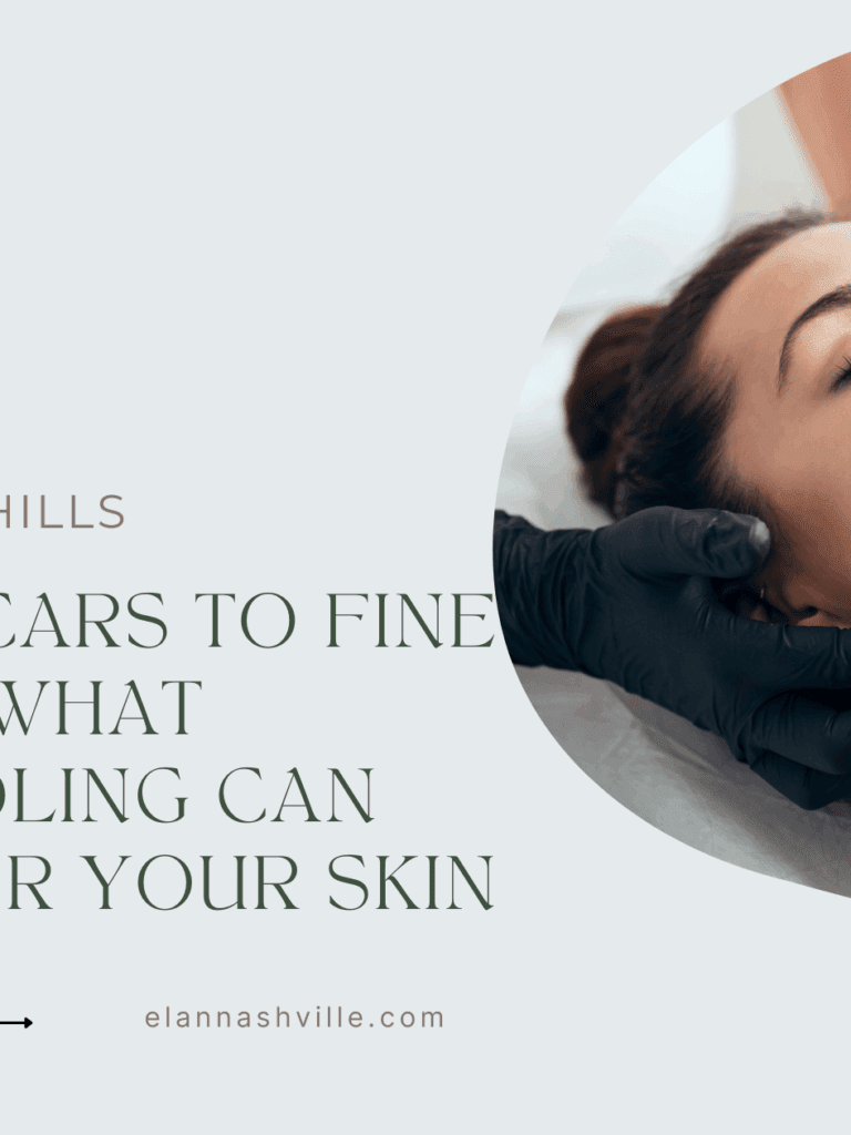 From Acne Scars to Fine Lines: What Microneedling Can Really Do for Your Skin