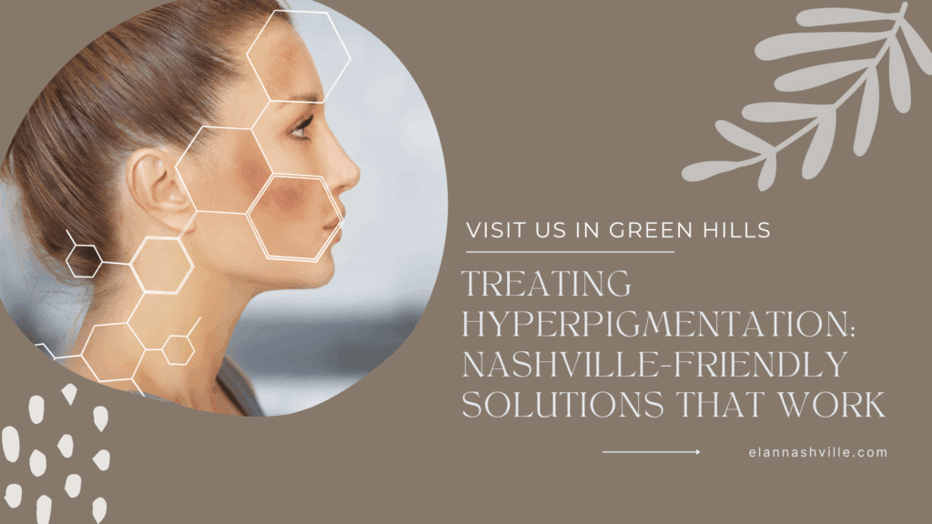 Close-up of a woman’s face with camera focused on hyperpigmentation, illustrating treatment options and effective skincare solutions available in Nashville.