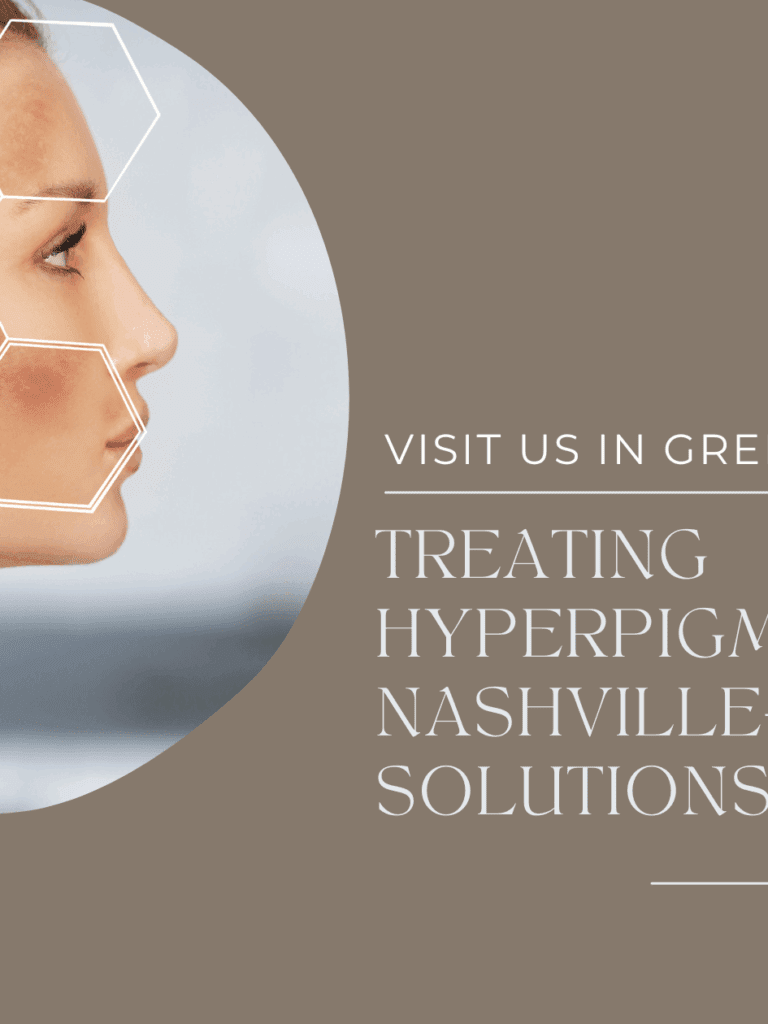 Treating Hyperpigmentation: Nashville-Friendly Solutions That Work