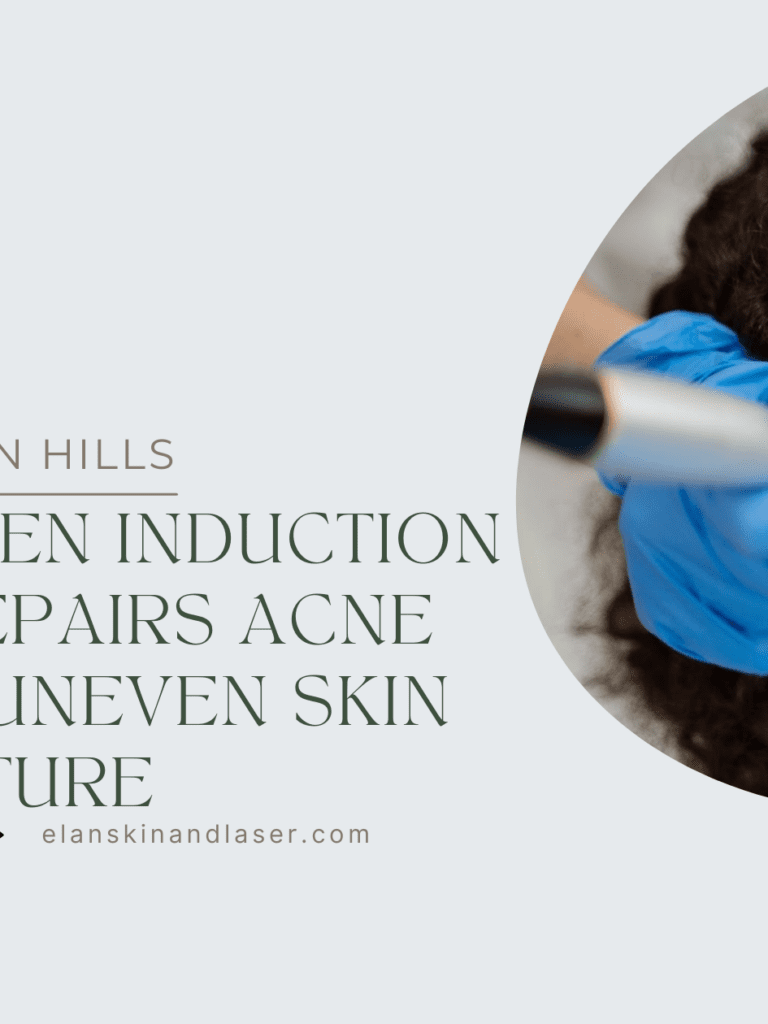 Microneedling Nashville: How Collagen Induction Therapy Repairs Acne Scars and Uneven Skin Texture