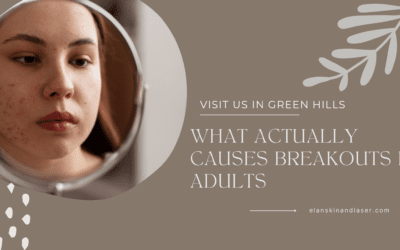 What Actually Causes Breakouts in Adults—and the Most Effective Clinical Treatments That Work