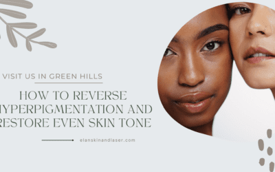 The Nashville Guide to Treating Sun Damage: How to Reverse Hyperpigmentation and Restore Even Skin Tone