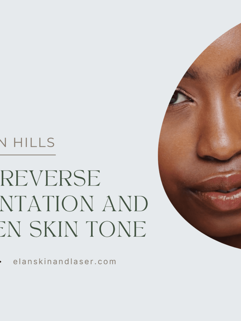 The Nashville Guide to Treating Sun Damage: How to Reverse Hyperpigmentation and Restore Even Skin Tone